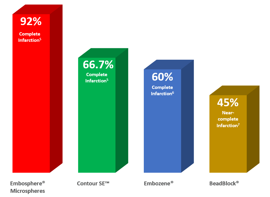 Image: Bar chart comparing complete infarction rates of Embosphere Microspheres (92%), to Contour SE (66.7%), Embozene (60%), and BeadBlock (45%, near-complete)