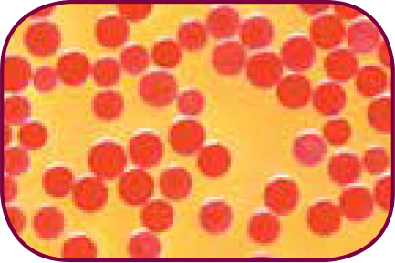 embogold-microspheres