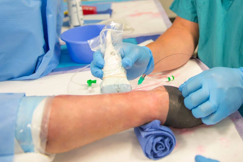 Peripheral Intervention Products Access, Angiography, Biopsy & More