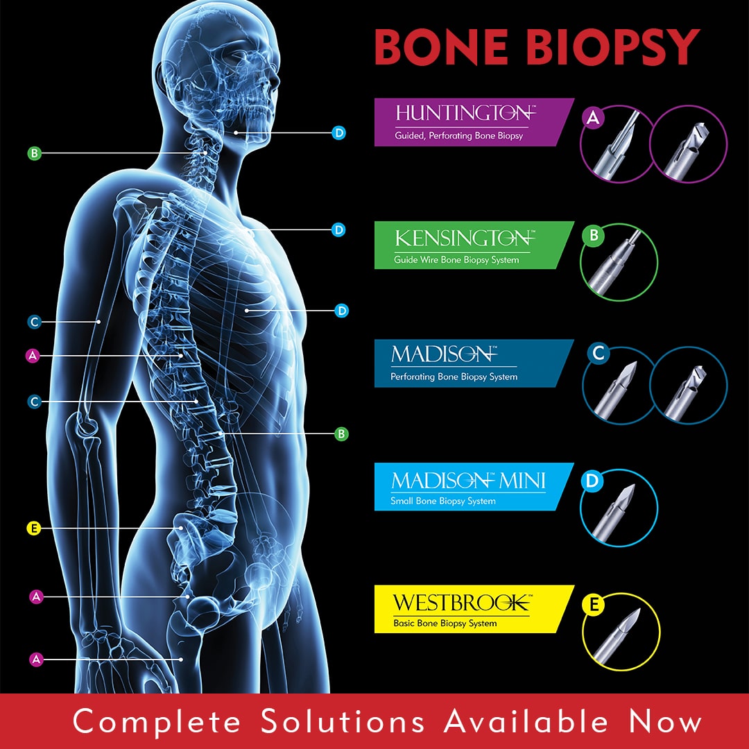 Bone Biopsy Solutions Available Now