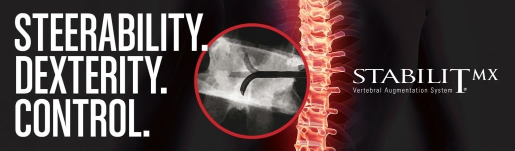 StabiliT MX Vertebral Augmentation System - 操縦性、器用さ、コントロール - Merit Medical