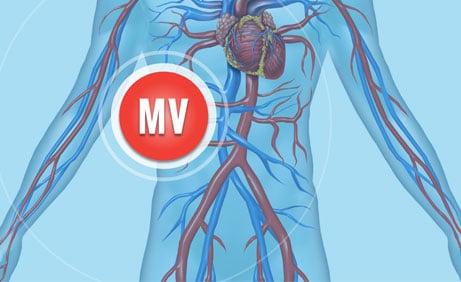 Merit Vascular Division