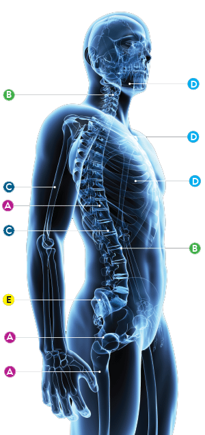 Sistema de biópsia óssea da Merit Medical Systems, Inc