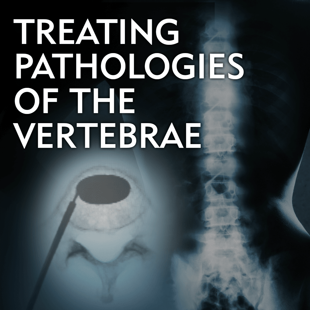 Treating Pathologies of the Vertebrae - Merit Medical - VCF and Spinal Tumor Ablation