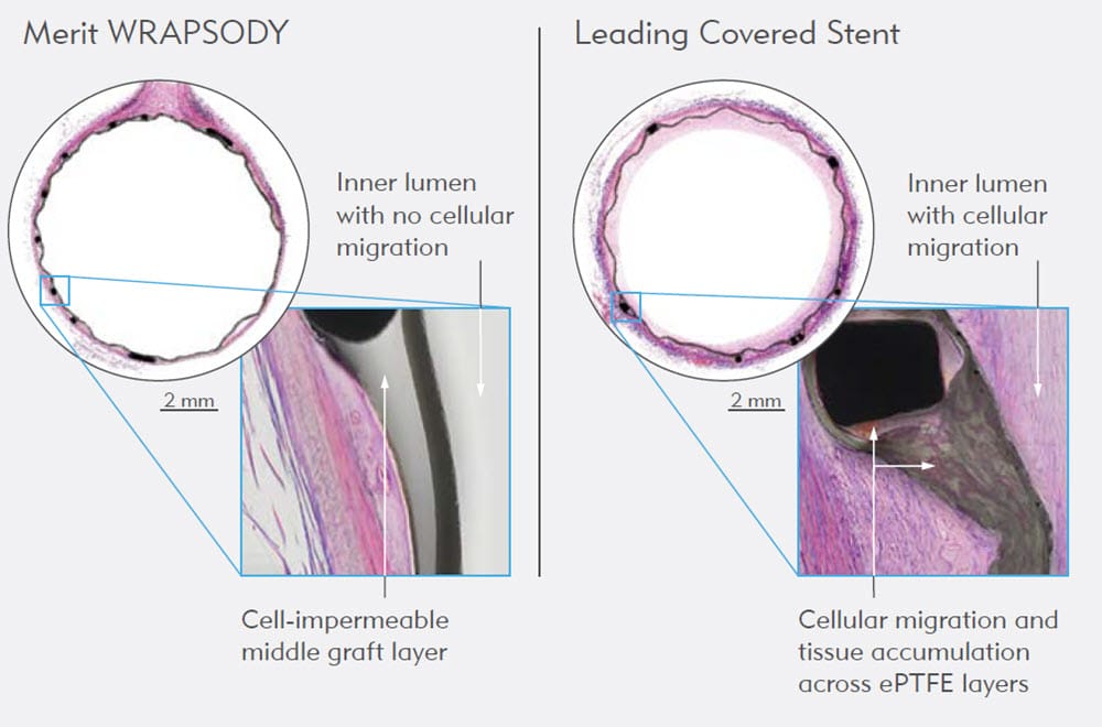 Dolmatch Findings - Merit WRAPSODY