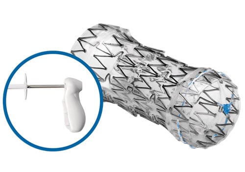 AERO Tracheobronchial Stent - Pulmonology Products - Merit Med Endoscopy