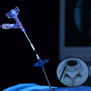 BIPEDICULAR FOOTPRINT VIA UNIPEDICULAR APPROACH - Arcadia Balloon Catheter - Merit Medical