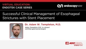 Esophageal Stricture Management - On-Demand Webinar - Merit Medical Endoscopy