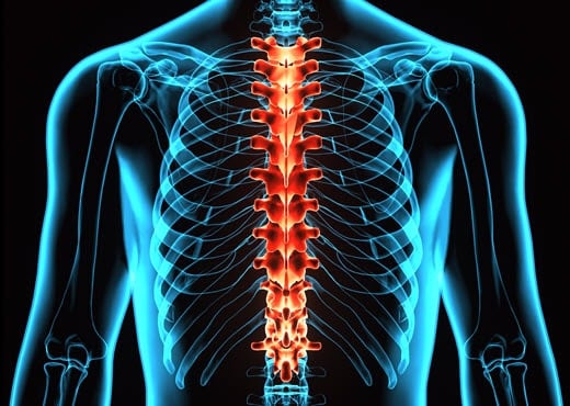 Spine Solutions