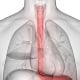 Helping You Understand Esophageal Cancer