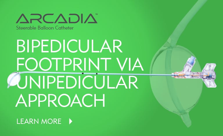 Arcadia - Create a Bipedular Footprint with a Unipedicular Approach