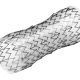 Addressing Complications of Esophageal Stenting with the EndoMAXX® Stent