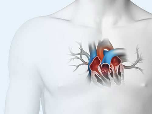 Think Transseptal - Educação Médica de Acesso Transeptal