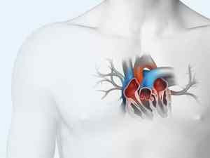 Think Transseptal - Transseptal Access Physician Education