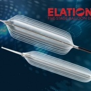 Elation5 - Dilation Reimagined