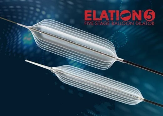 Elation5 - Dilation Reimagined