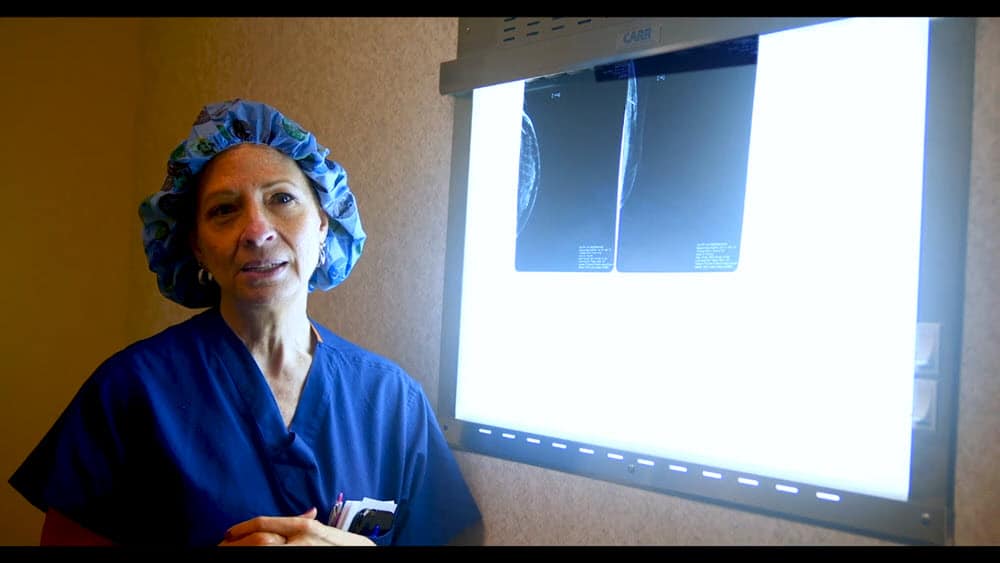 Partial Mastectomy Using SCOUT Radar Localization