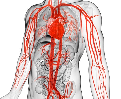 Aortic Aneurysm