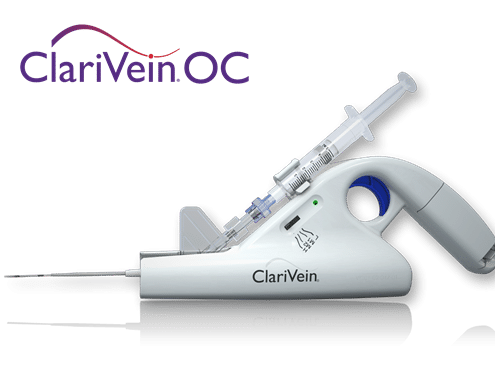ClariVein OC - treatment for endovenous mechanochemical ablation