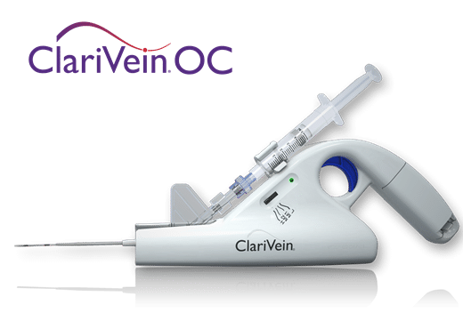 ClariVein OC - 静脈内メカノケミカル アブレーションの治療