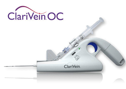 ClariVein OC - tratamento para ablação mecanoquímica endovenosa