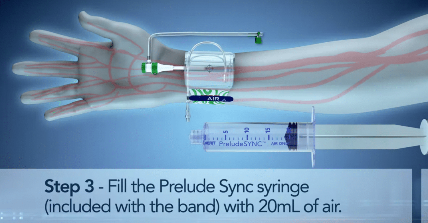 PreludeSYNC™ Radiales Kompressionsgerät persönlich und effektiv