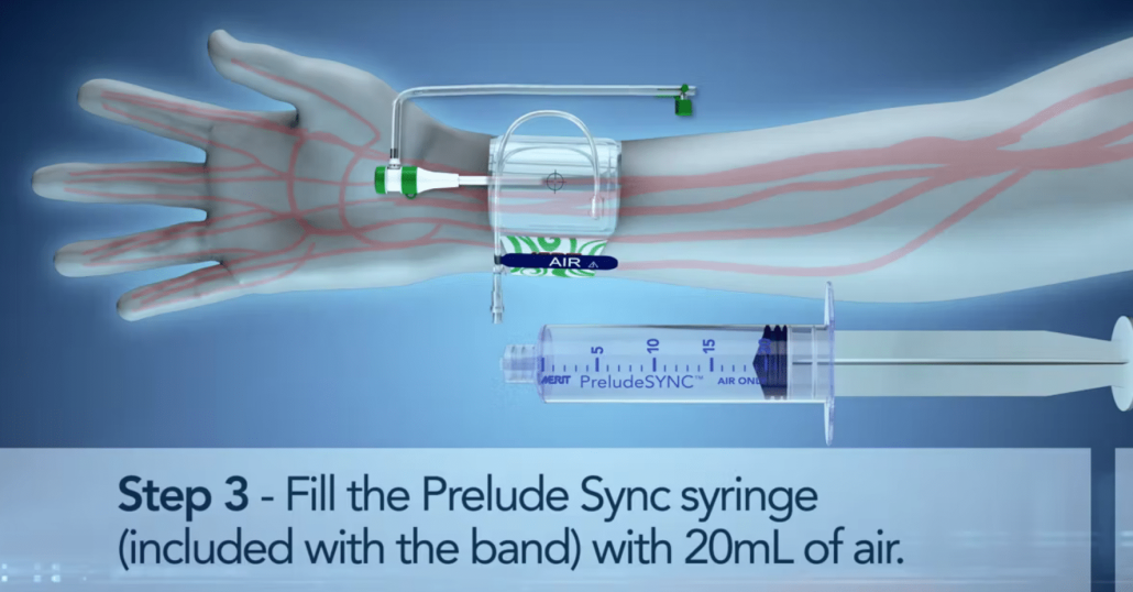 PreludeSYNC&trade; Radial Compression Device