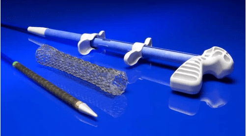 Introducing the EndoMAXX Esophageal Stent