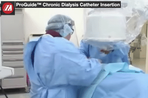 ProGuide™ Chronic Dialysis Catheter Insertion