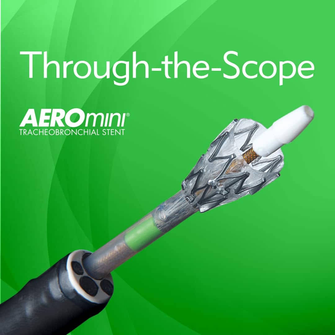 AEROmini - Through The Scope