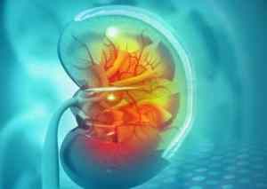 Merit Recognizes National Kidney Month