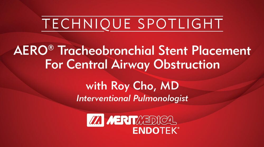 AERO TRACHEOBRONCHIAL STENT PLACEMENT FOR CENTRAL AIRWAY OBSTRUCTION [IN-SERVICE]