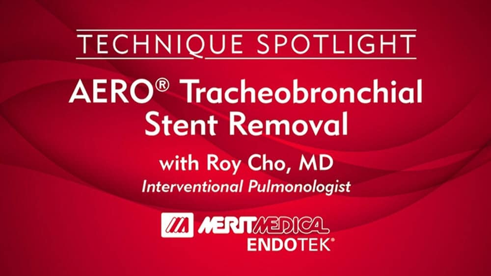 AERO TRACHEOBRONCHIAL STENT REMOVAL [IN-SERVICE]