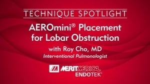 AEROMINI PLACEMENT FOR LOBAR OBSTRUCTION [IN-SERVICE]