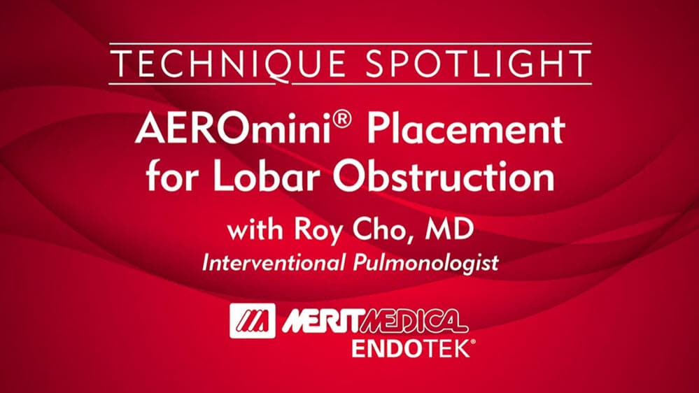 AEROMINI PLACEMENT FOR LOBAR OBSTRUCTION [IN-SERVICE]
