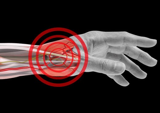 Cut away image of wrist with bullseye on distal radial artery