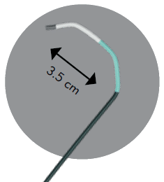 Ultimate 2 - ConcierGE Guiding Catheter