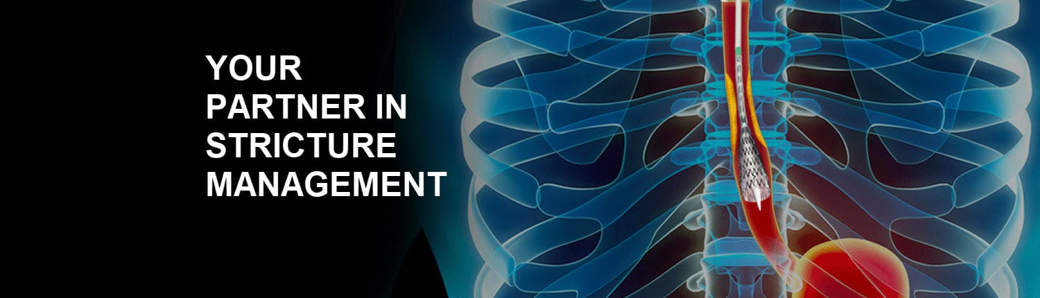 GI Stricture Management - image of esophagus with stent coming down it