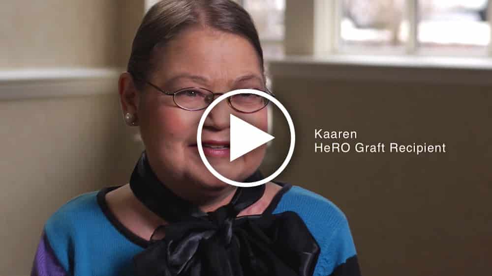 Is HeRO Graft right for me? Hear Kaaren discuss her experience with the HeRO Graft