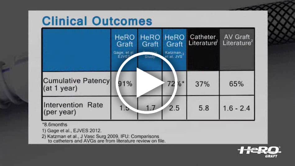 Watch Dr. John R. Ross perform a thrombectomy procedure of the HeRO Graft.