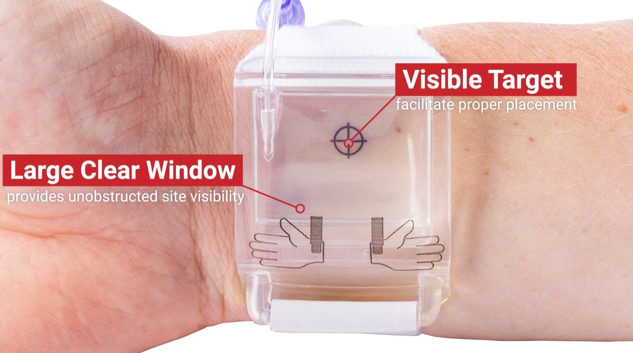 PreludeSYNZ EZ - Image from In-Service Video showing the large, clear window of the compression device