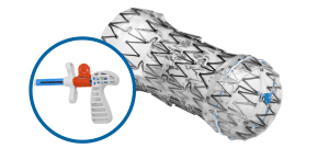 AERO Tracheobronchial Stent