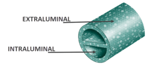 Cut out of the BioFlo Duramax catheter showing the extraluminal surface, and the intraluminal surface