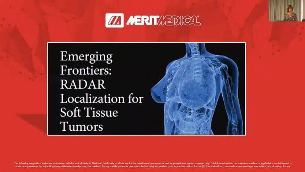 Screengrab of the webinar Emerging Frontiers: RADAR Localization for Soft Tissue Tumors