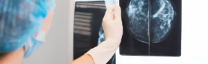 Capped physician looking at X-ray images of breast tissue