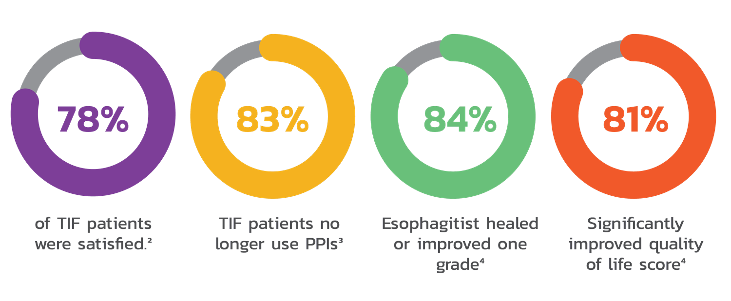 Infographic showing 4 circular representations of specific rates. Purple circle: 78% of TIF patients were satisfied. Yellow Circle: 83% of TIF patients no longer use PPIs. Green circle: 84% of esophagitist healed or improved one grade. Orange circle: 81% significantly improved quality of life.