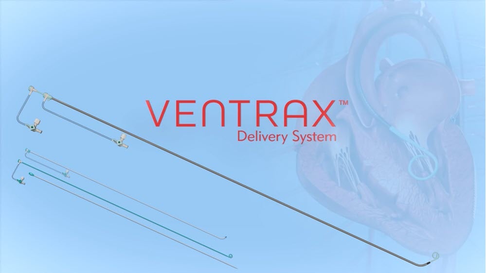 Introducing the Ventrax Delivery System