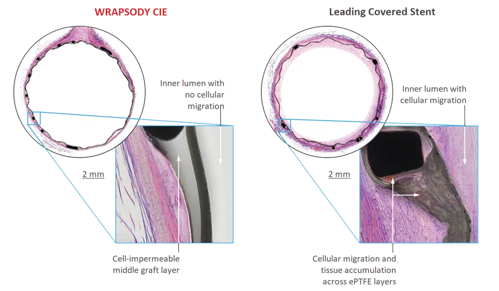 Image shows the extent of cellular migration within the WRAPSODY CIE vs a leading covered stent