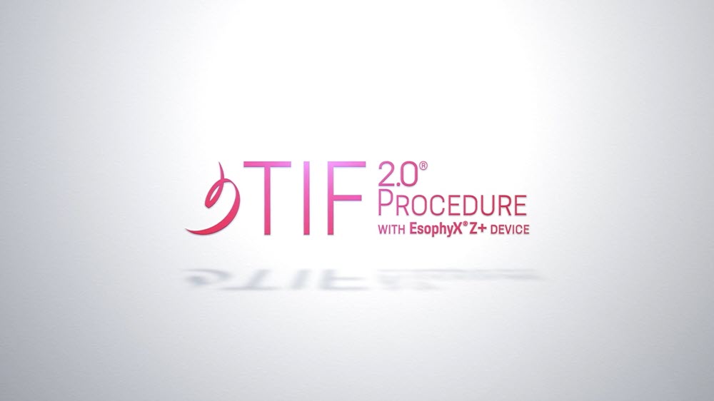 TIF 2.0 PROCEDURE WITH THE ESOPHYX Z+ DEVICE