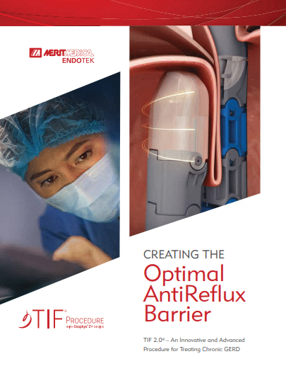 Tif Device TIF 2.0® by Merit Medical | GERD Treatment | Clinically Proven